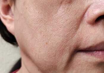 延岡市でたるみケアならグレースへ！40代から顔がたるむ理由とは？