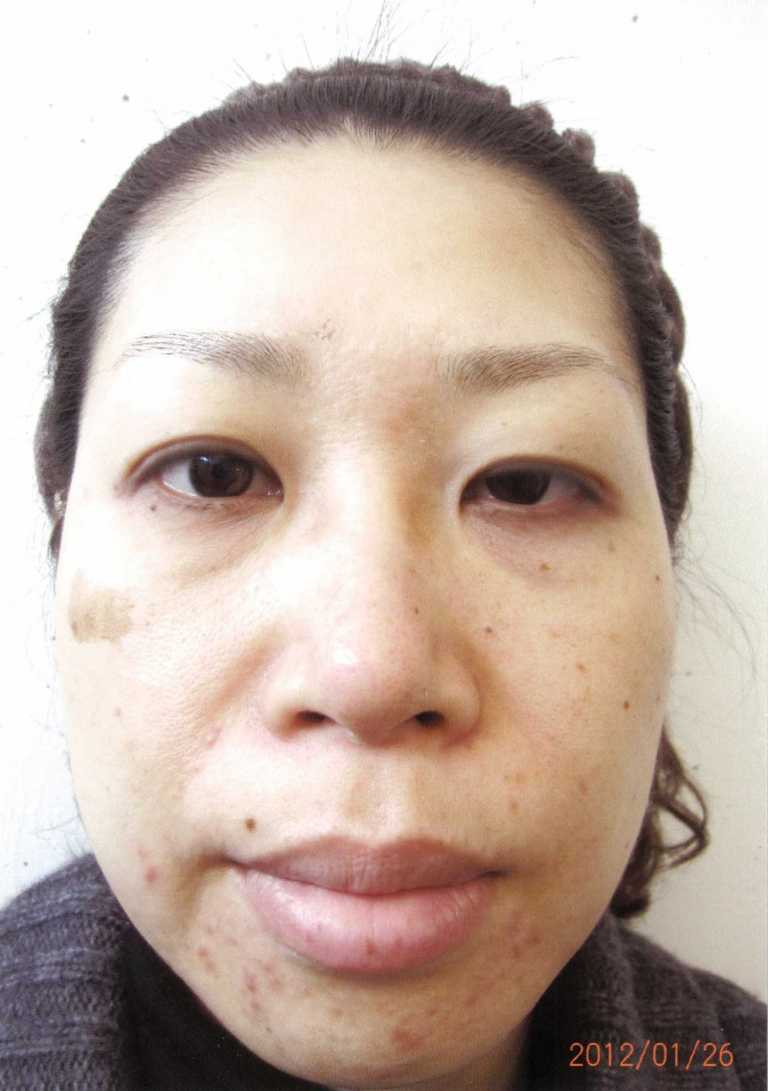 BEFORE写真３
