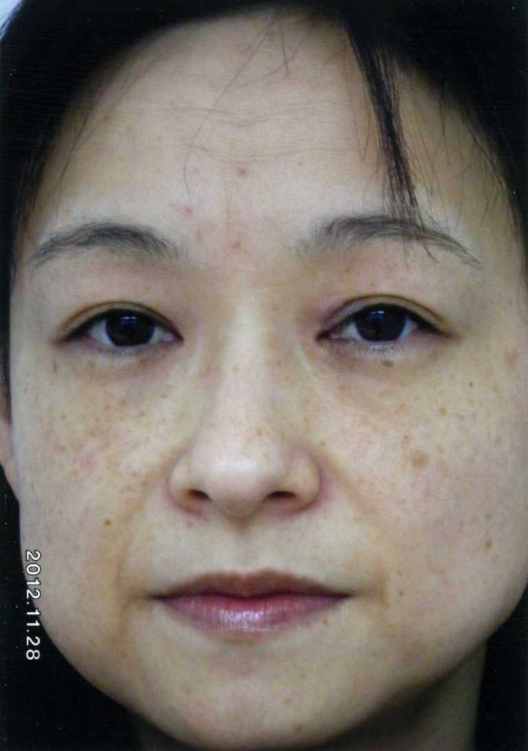 BEFORE写真３