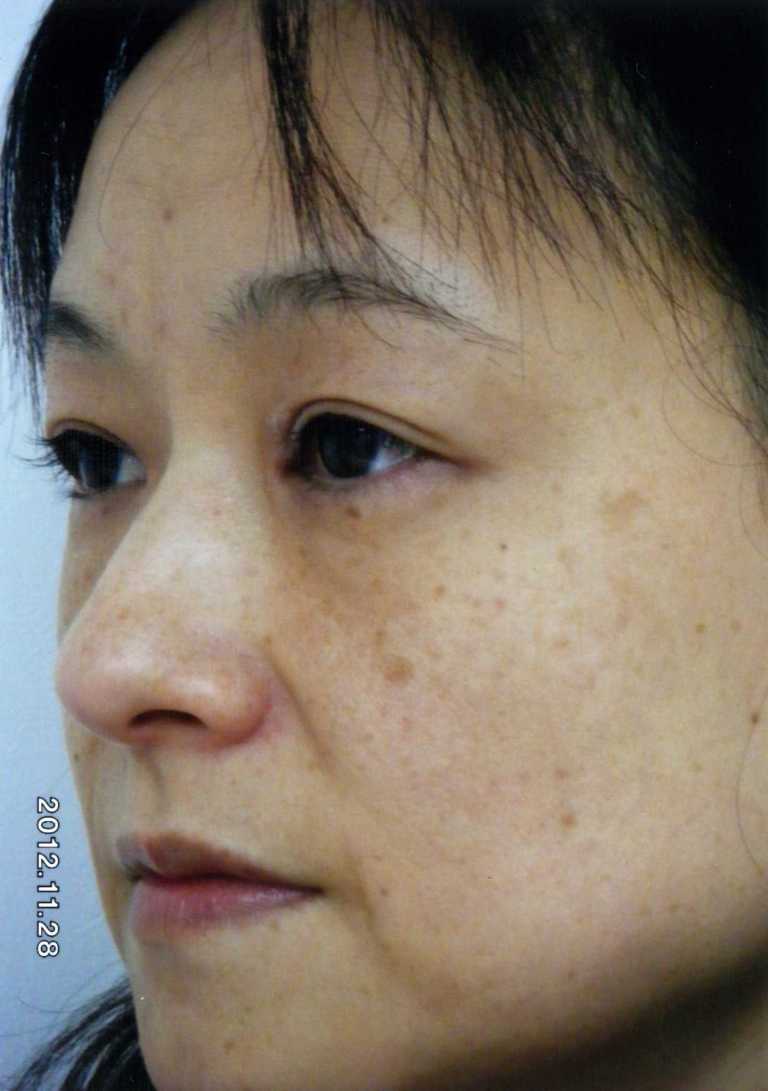 BEFORE写真２