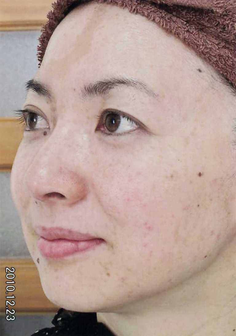 BEFORE写真２