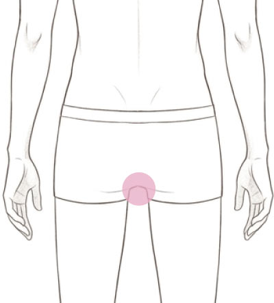 Oライン