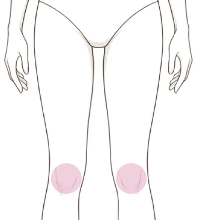 ひざ小僧